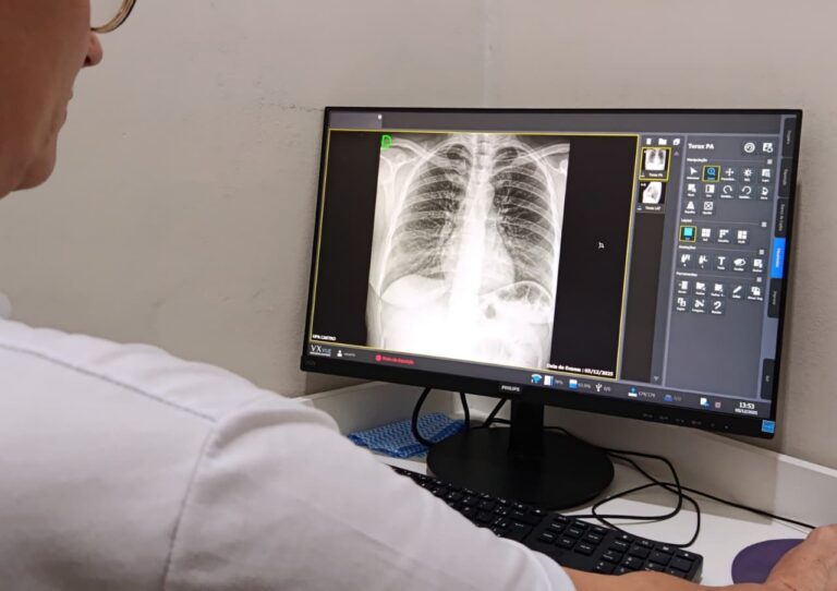 Prefeitura viabiliza serviço de Raio-X 24h na UPA de Castro